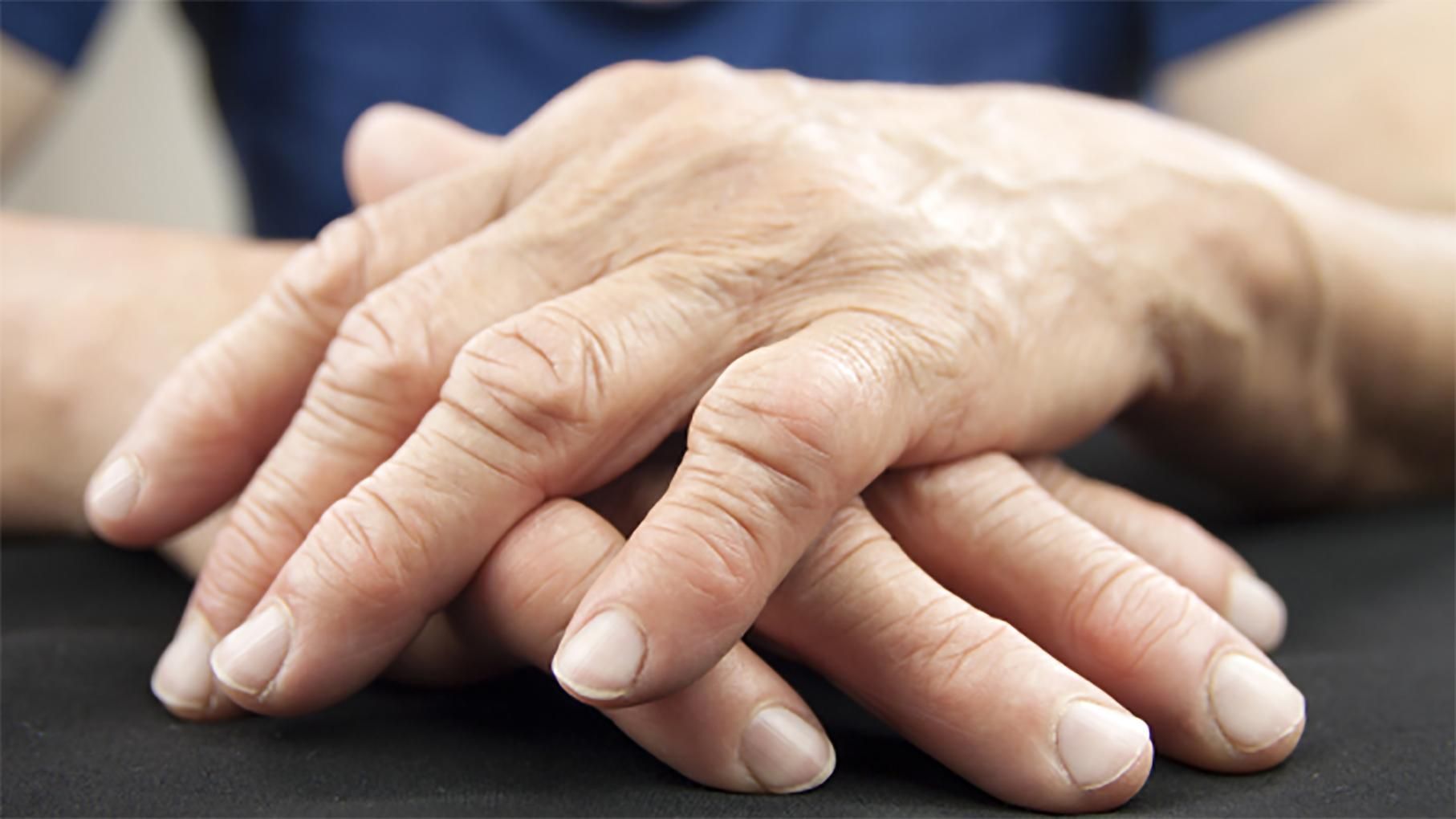 5 безкоштовних мобільних додатків для боротьби з ревматичним артритом