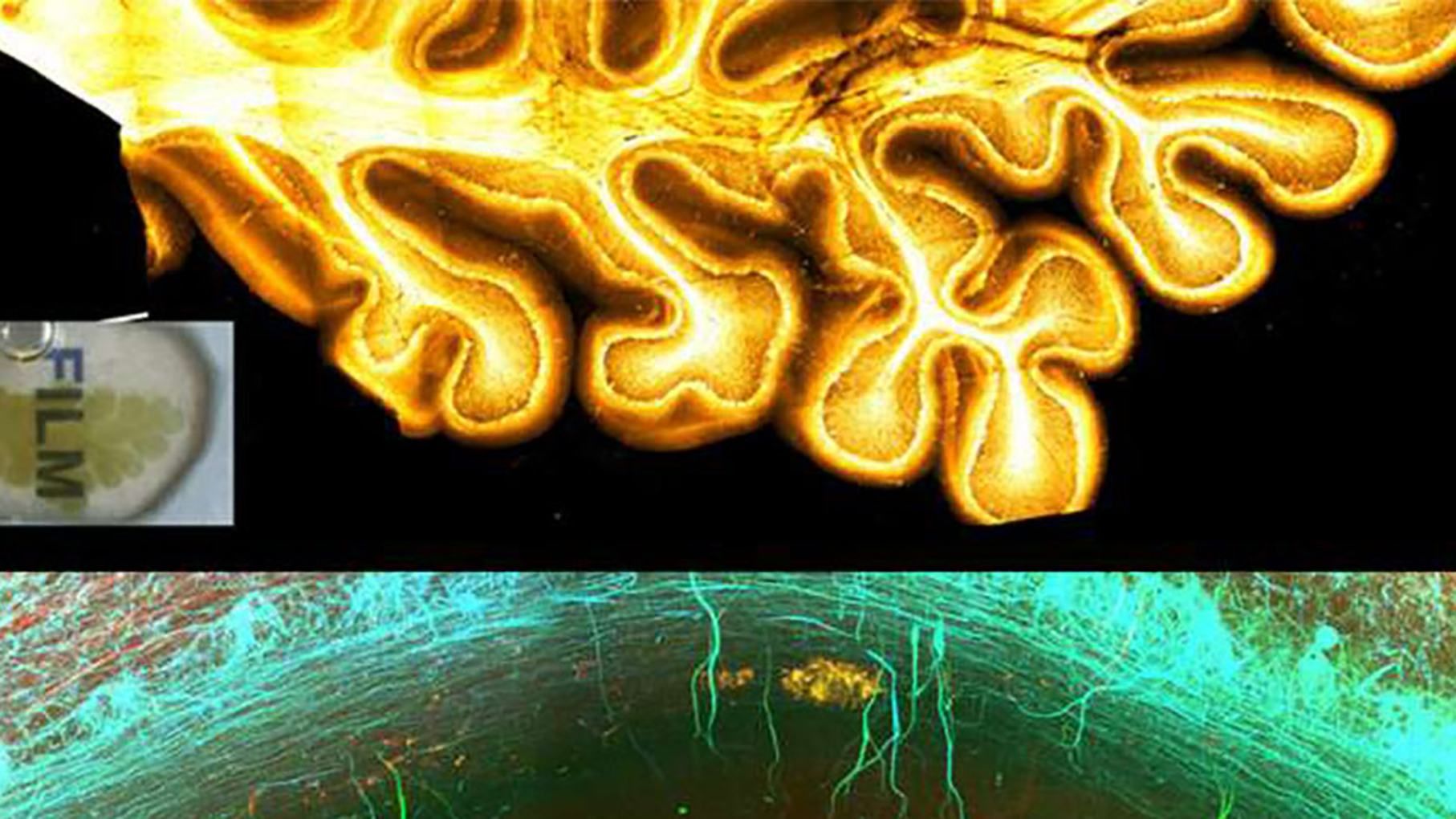 Як виглядає мозок в барвистій 3D-проекції Як виглядає мозок в барвистій 3D-проекції