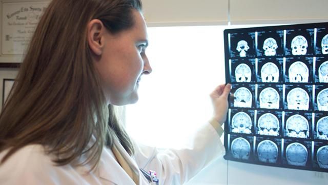 Як струс мозку впливає на організм та до чого це може призвести Як струс мозку впливає на організм та до чого це може призвести