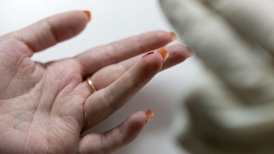 Ученые изобрели инновационный метод, что будет способствовать быстрому заживлению ран