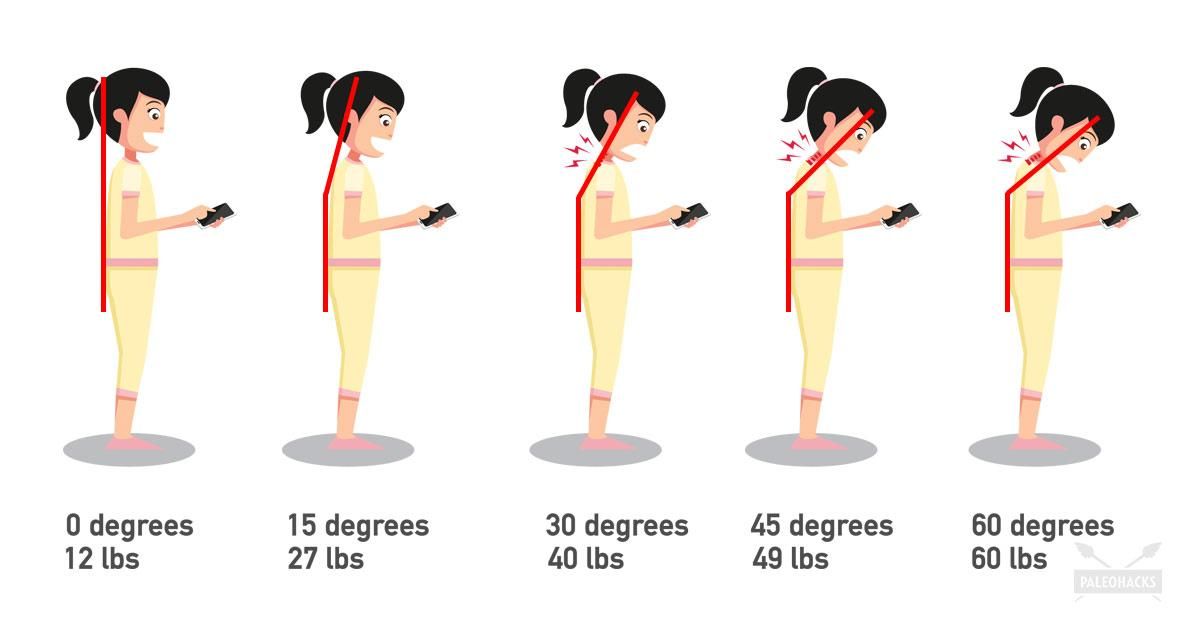 Німіють пальці і болять очі? – Супрун розповіла про недугу XXI століття Німіють пальці і болять очі? – Супрун розповіла про недугу XXI століття