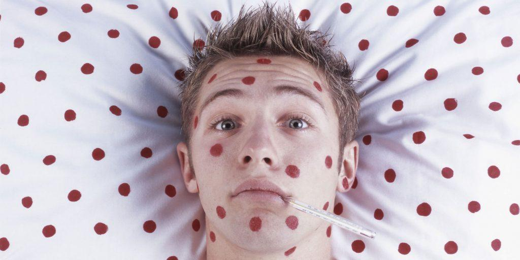 Врач рассказал, почему корь опаснее для взрослых, чем для детей