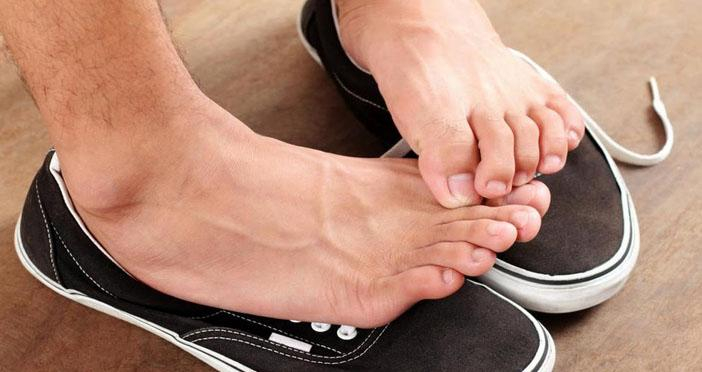 Что делать, если сильно потеют ноги