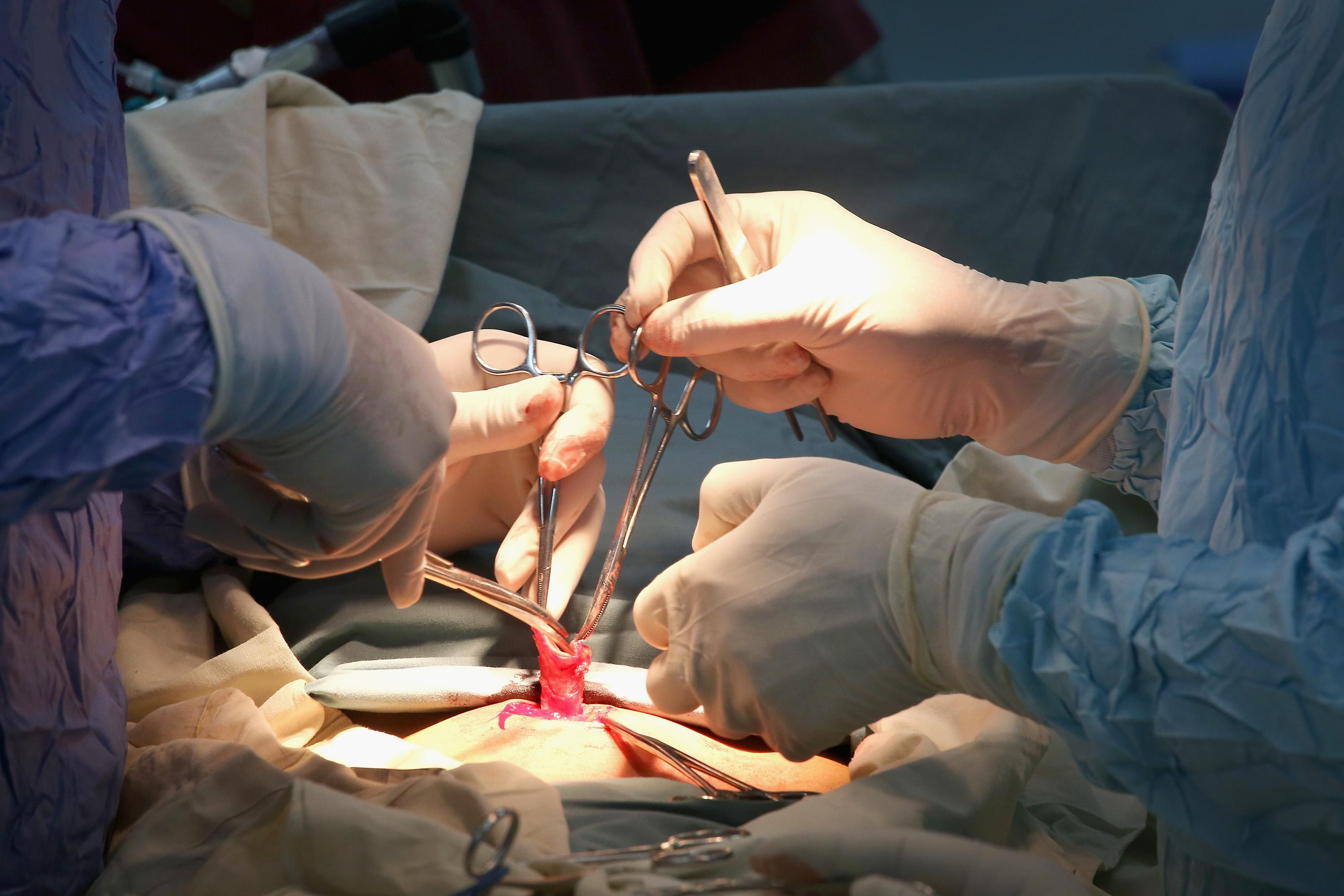 Сердечные стенты как пример борьбы с коррупцией в Украине