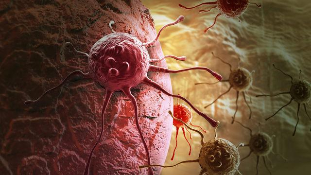 Где ожидается "вспышка" рака: жуткий прогноз