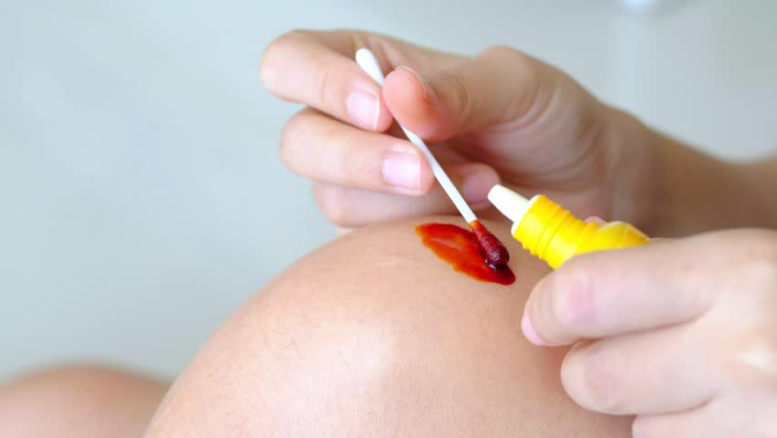 В Украине запретили лекарство Лаферобион и антисептик Йод