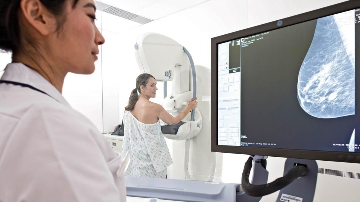 Назвали способ, который снизит смертность от рака груди на 60%