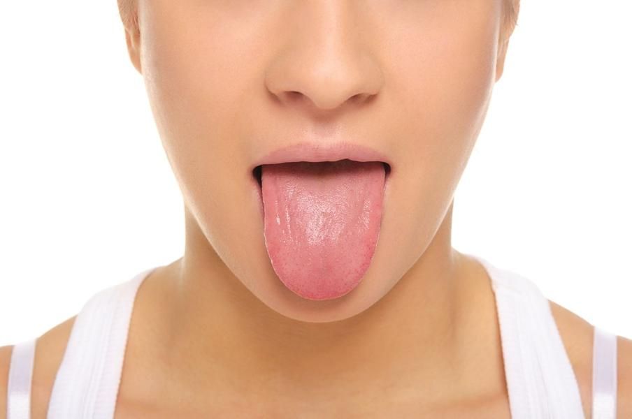 Тріщини на язиці: причини виникнення та лікування