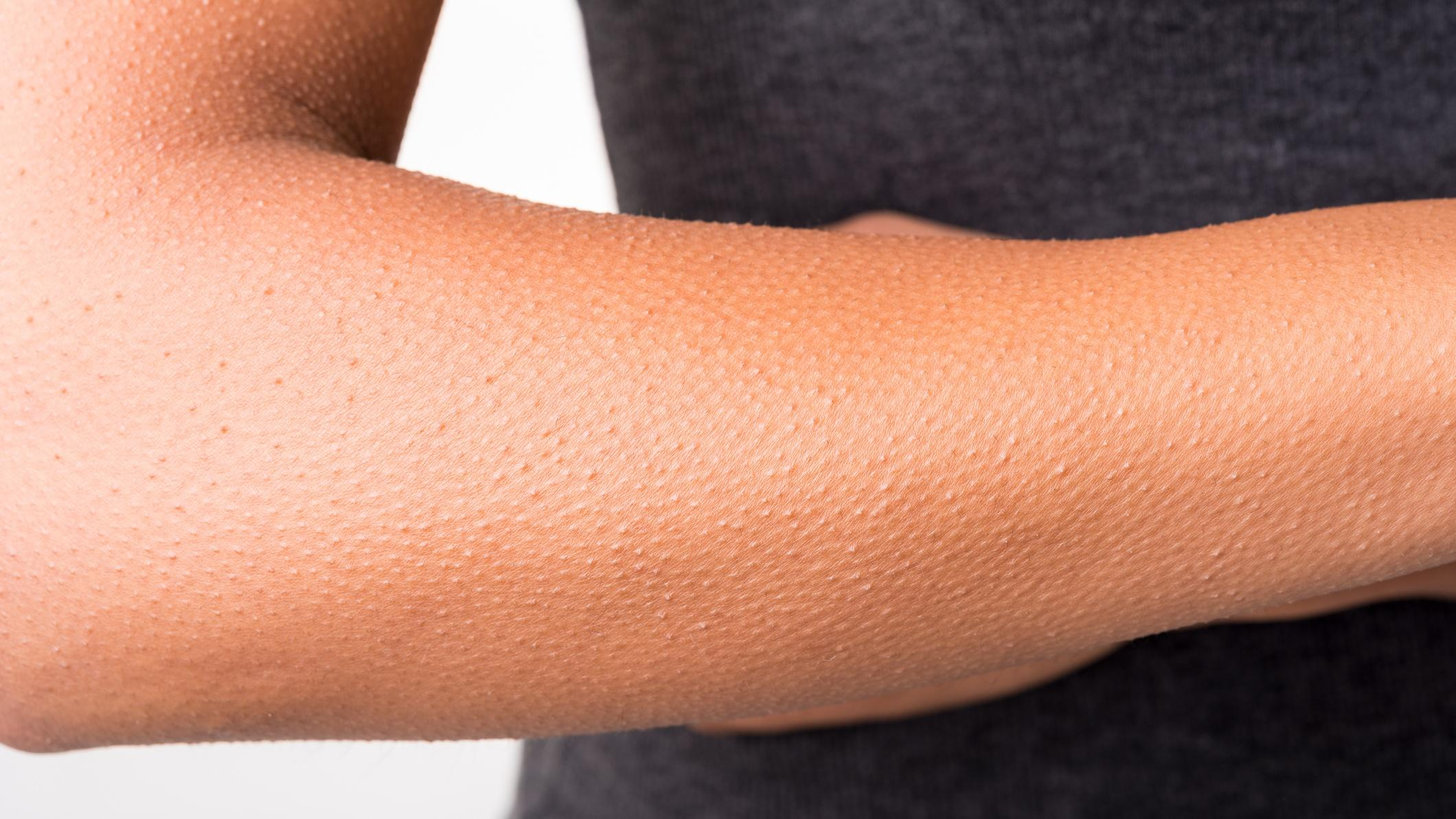 Назвали неожиданный фактор, который стимулирует рост волос