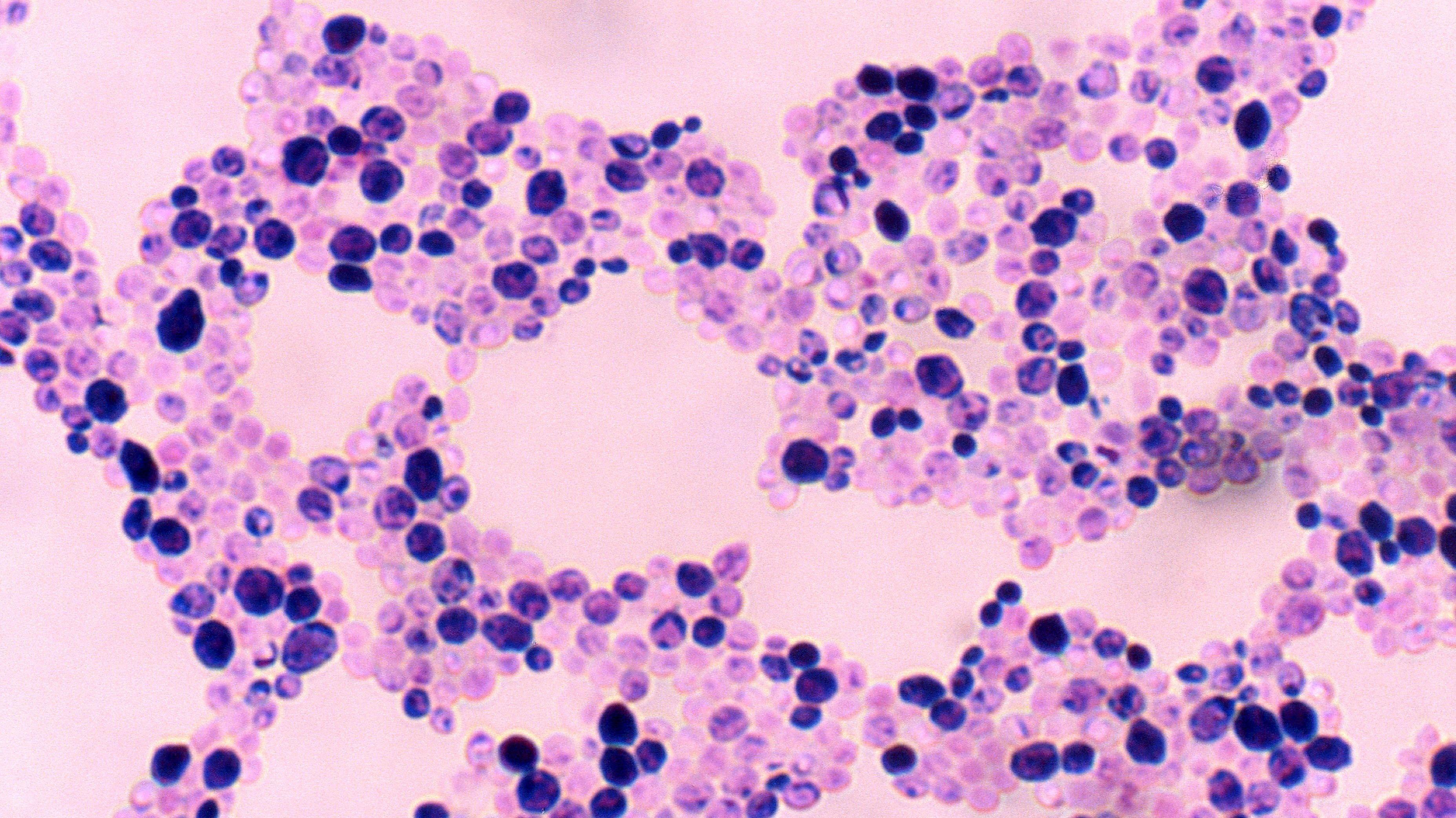 Поширений вид грибку може викликати інфекцію мозку та порушити пам'ять, – вчені Поширений вид грибку може викликати інфекцію мозку та порушити пам'ять, – вчені