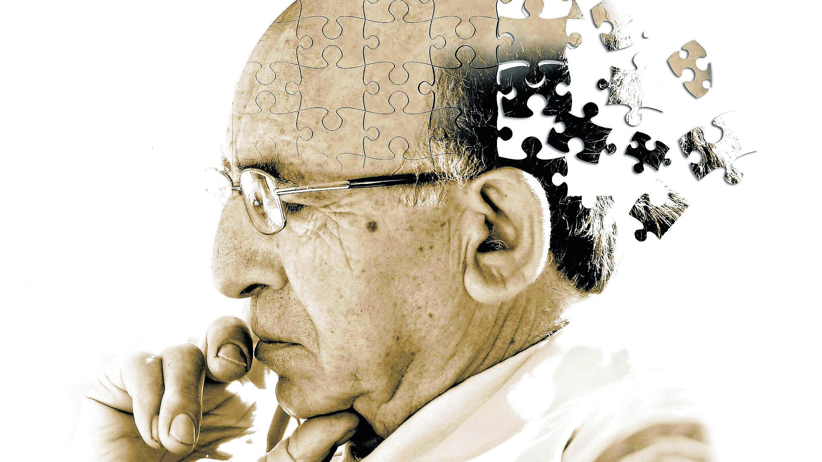Нейросеть может выявить болезнь Альцгеймера за 6 лет до диагноза