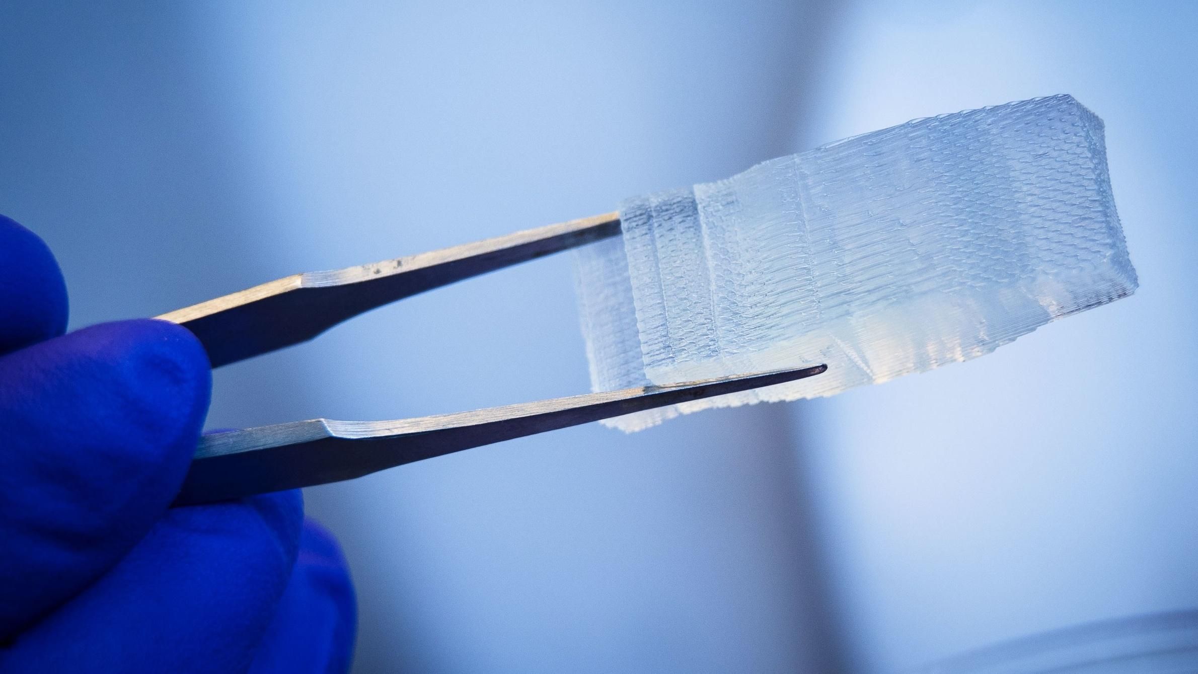 Надрукований на 3D-принтері імплант допоміг зростили зламаний хребет Надрукований на 3D-принтері імплант допоміг зростили зламаний хребет