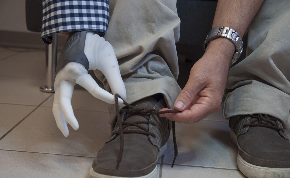 Вчені вперше підключили протез руки до нервів людини: цікаве відео