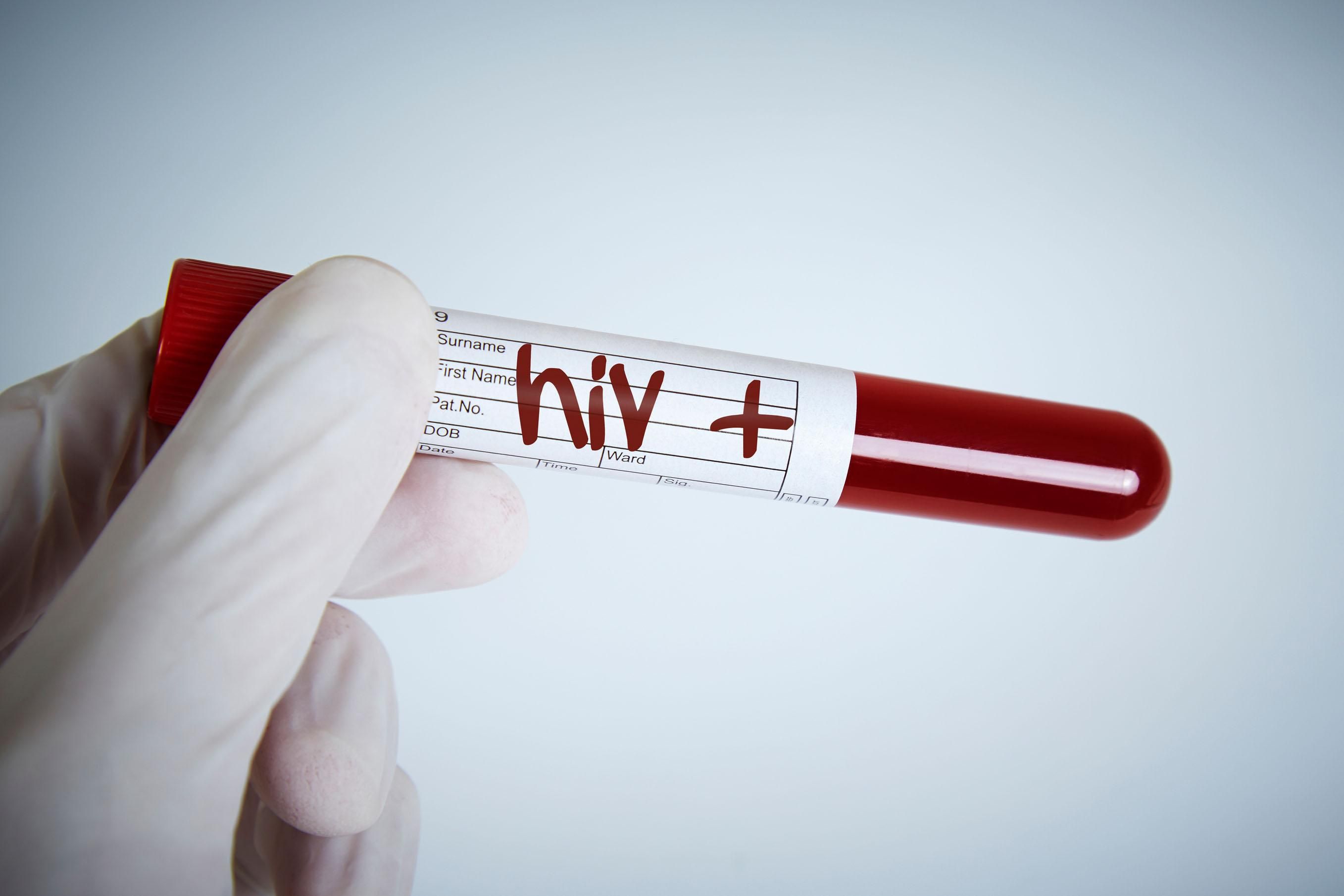 В Україні меншає ВІЛ-інфікованої молоді
