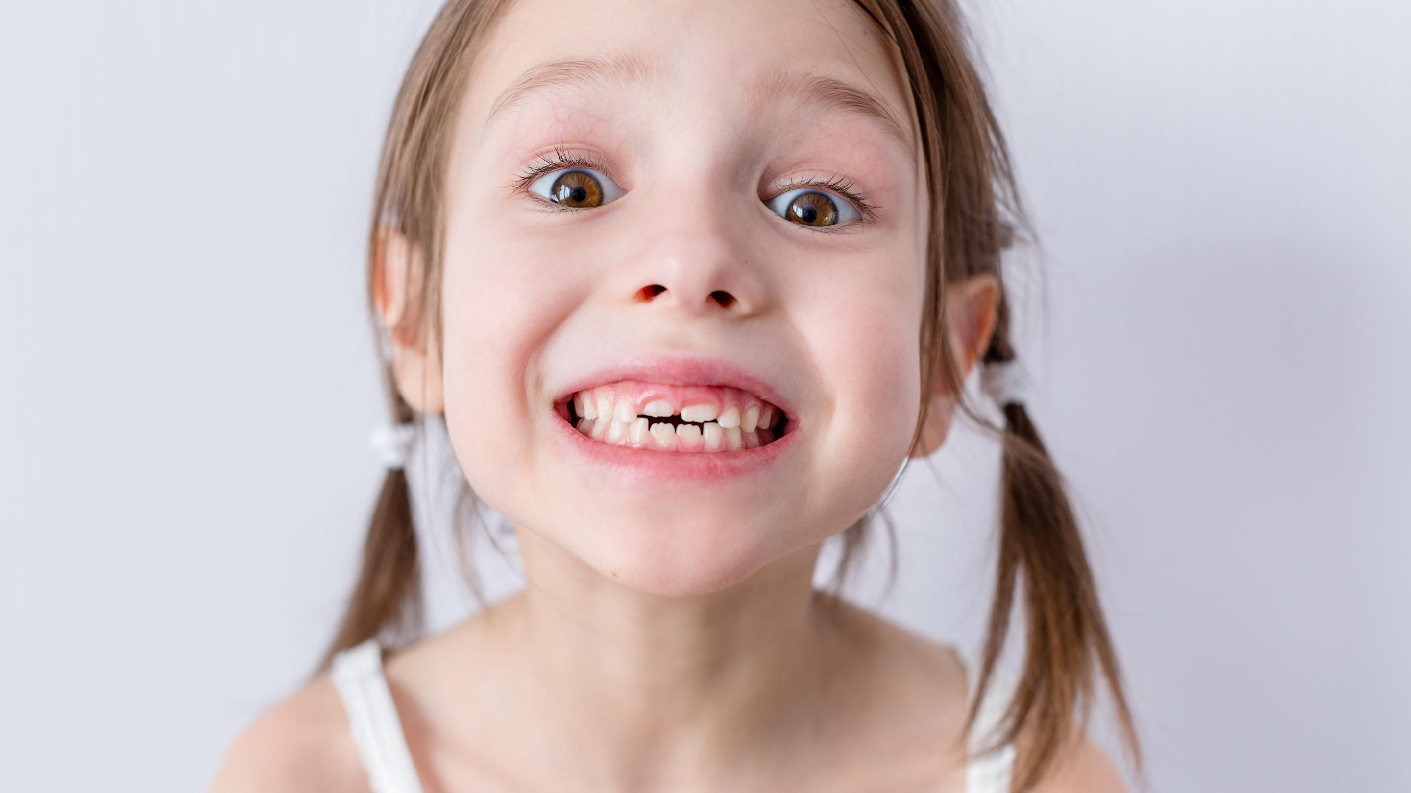 Молочні зуби розкажуть, чи матиме дитина проблеми з психікою