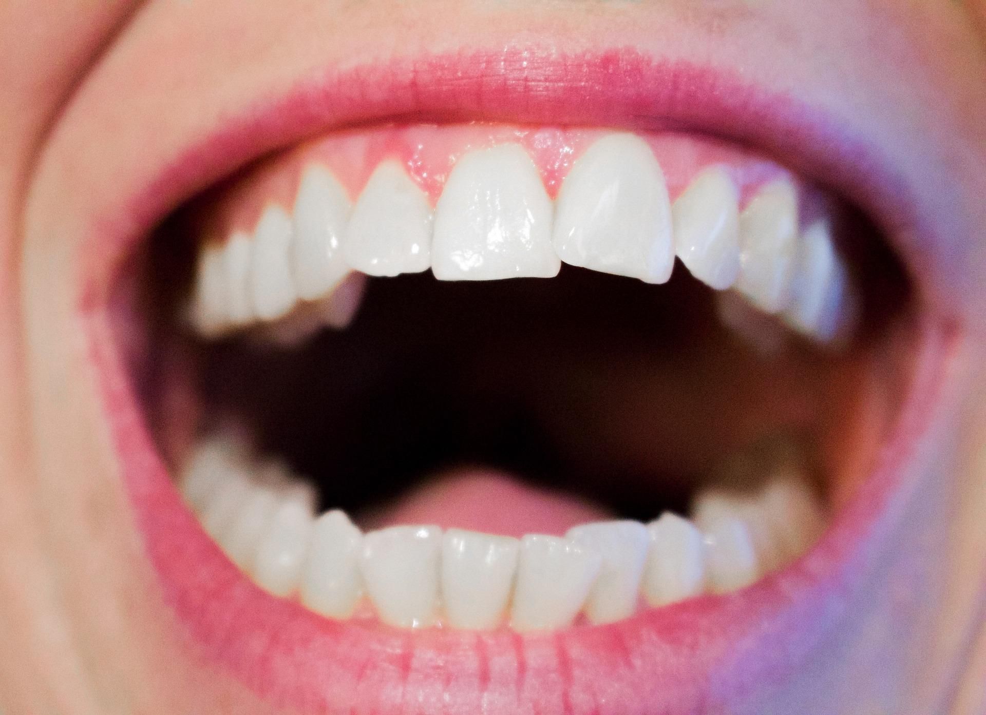 Бактерії в роті можуть викликати рак 