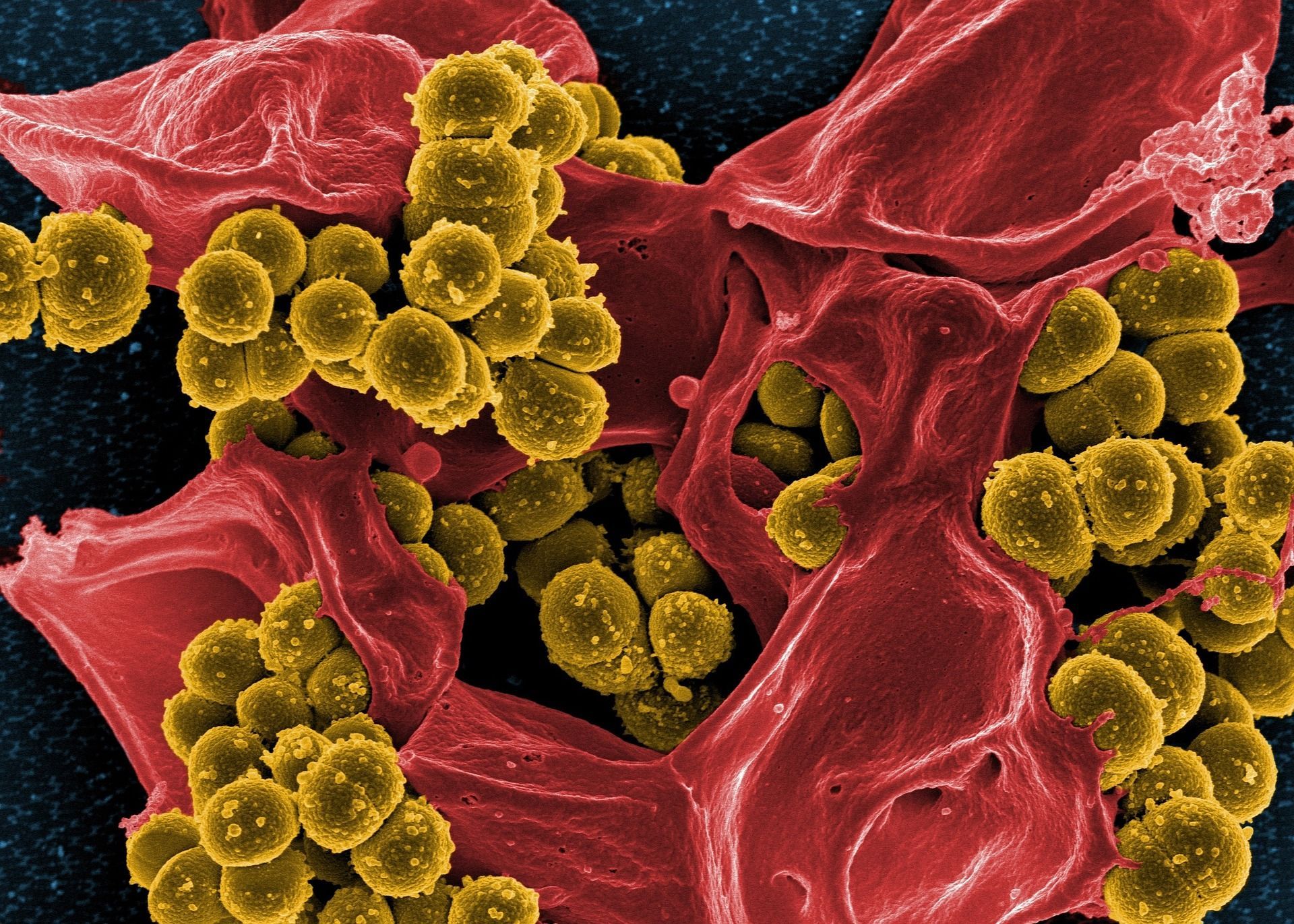 Как отличить вирусную инфекцию от бактериальной