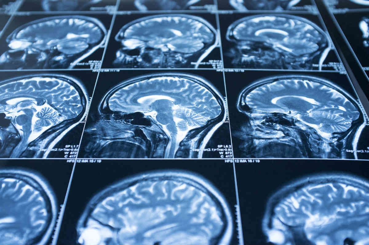 Як відрізнити струс мозку від звичайного забою Як відрізнити струс мозку від звичайного забою