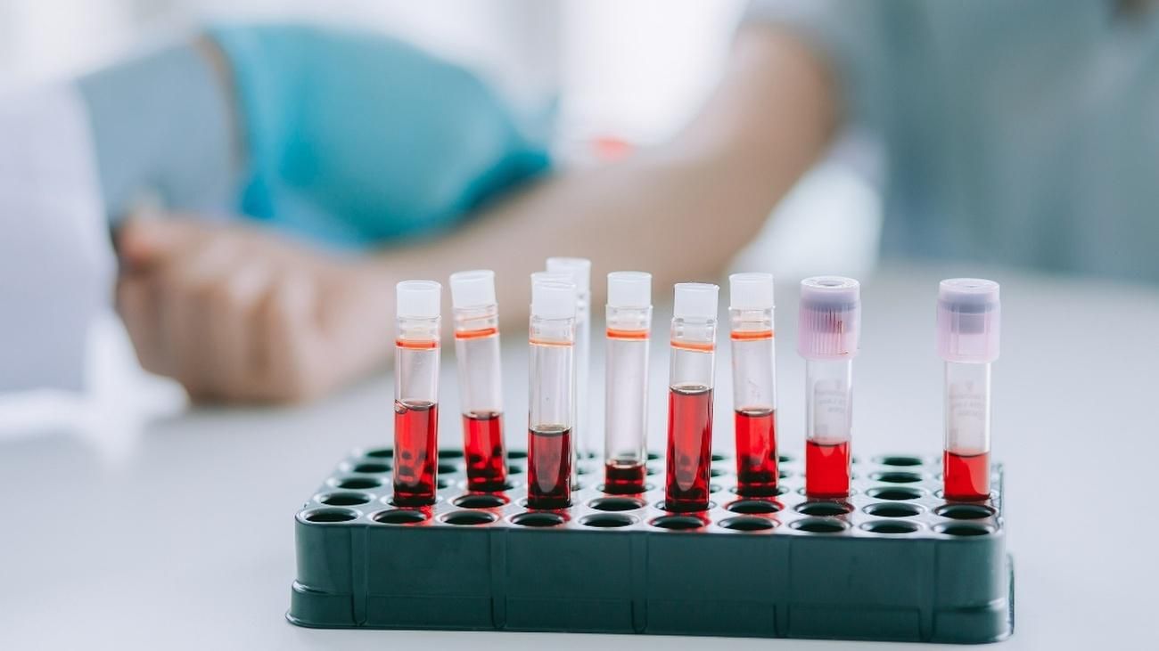 Назвали анализ крови, который не стоит сдавать на голодный желудок Назвали анализ крови, который не стоит сдавать на голодный желудок