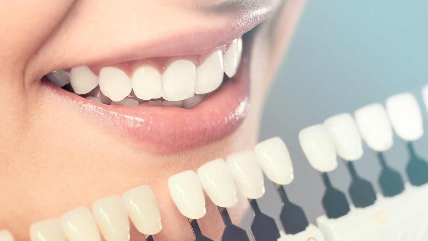 Які фактори впливають на колір зубів