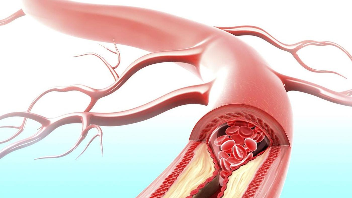 Какой признак указывает на развитие сердечной недостаточности