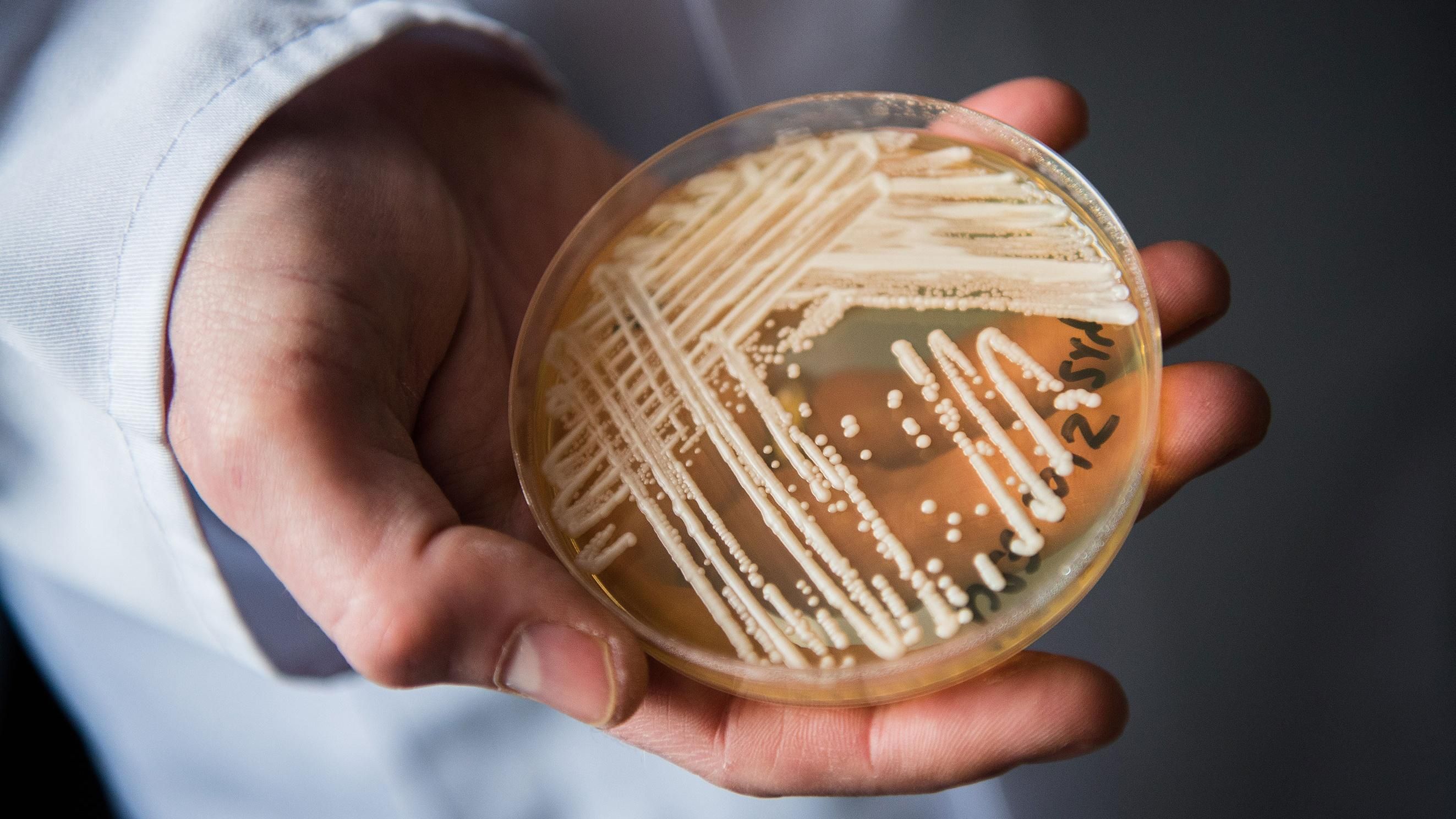 Новий супергрібок Candida auris: небезпека нового супергрібка для людей Новий супергрібок Candida auris: небезпека нового супергрібка для людей