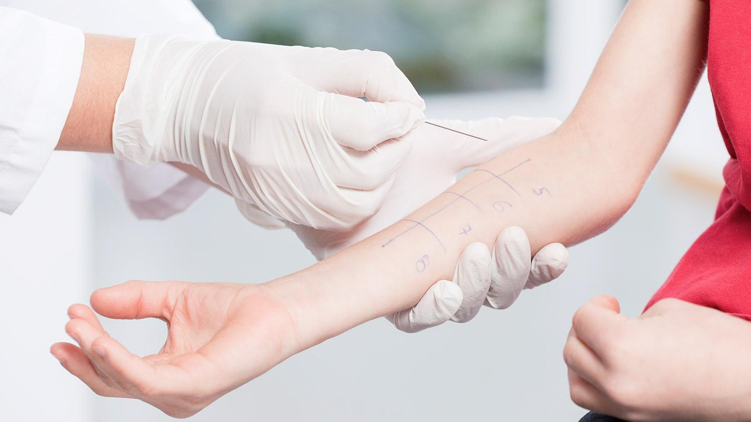 Какие анализы сдать, чтобы выявить аллергию