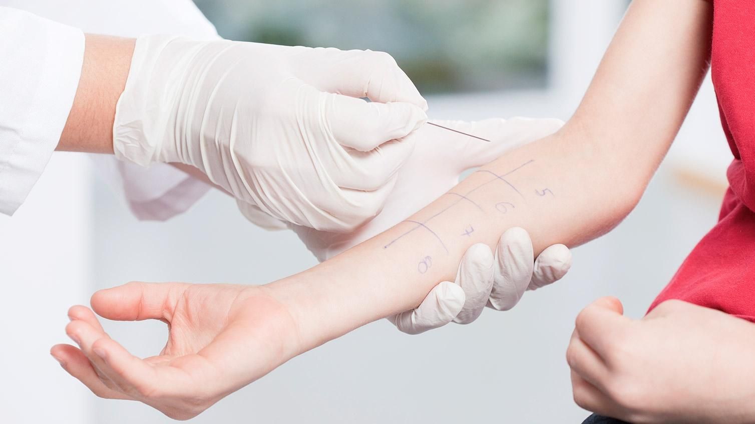 Какие анализы сдать, чтобы выявить аллергию Какие анализы сдать, чтобы выявить аллергию