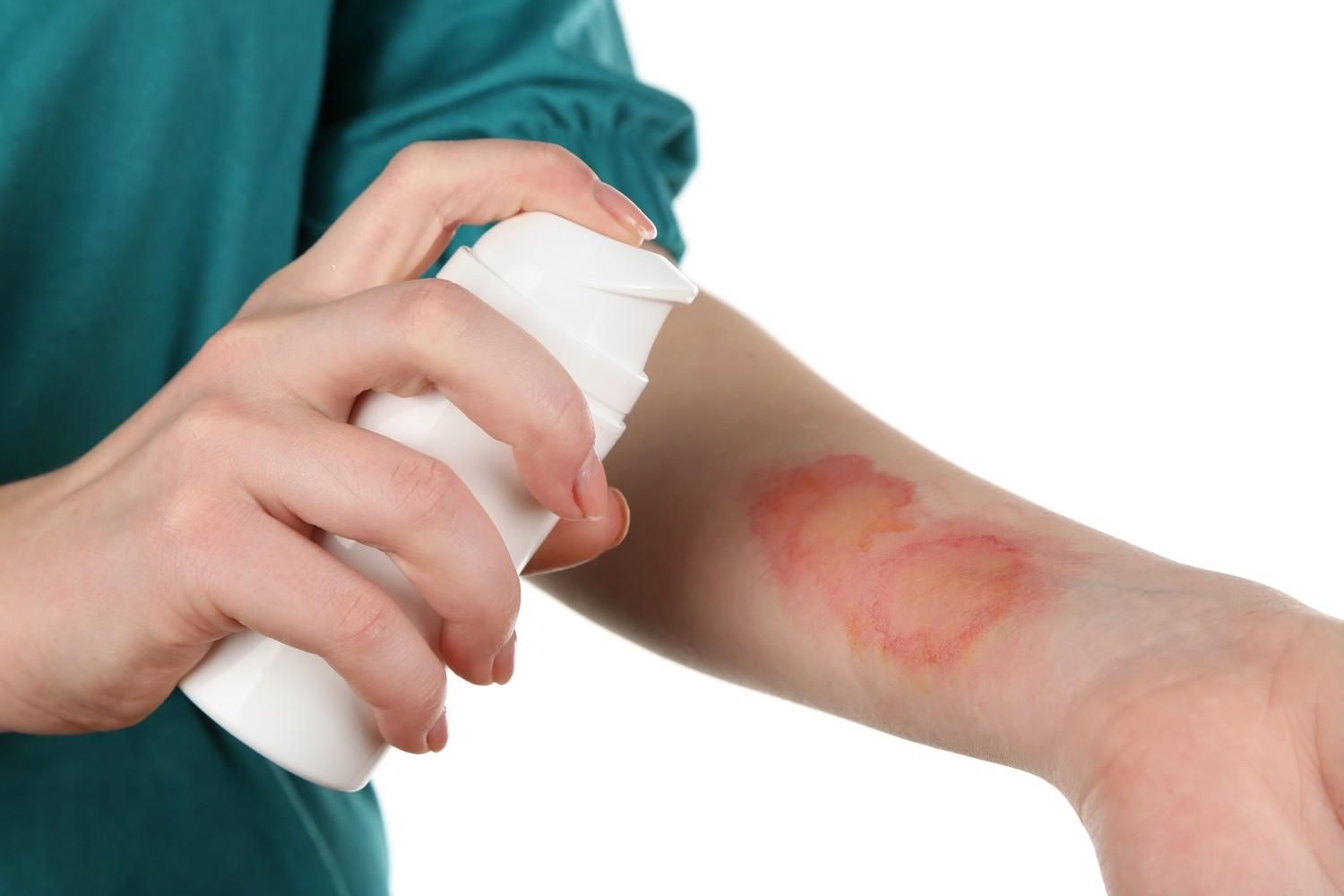 Распространенное заболевание кожи связано с возникновением рака