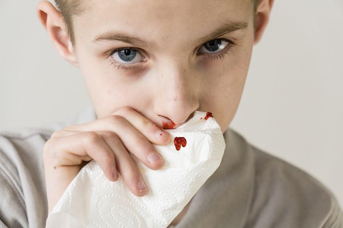 12 симптомів, які допоможуть розпізнати лейкоз у дитини