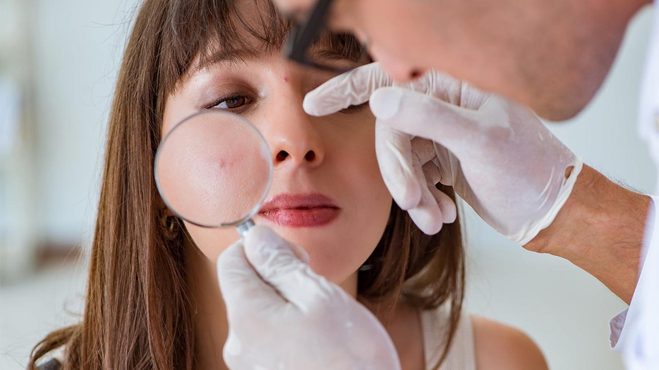 Супрун рассказала, как лечить прыщи и предотвратить их появление