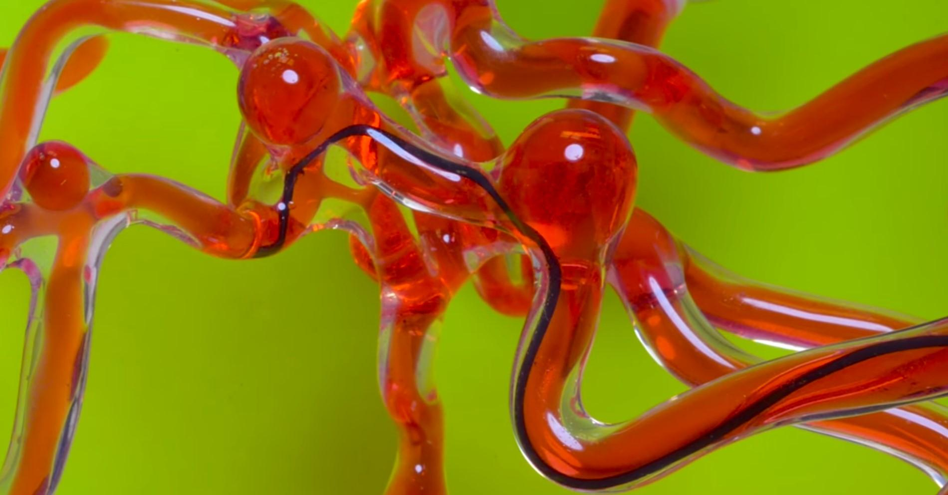 Создали робота-змею для лечения инсульта