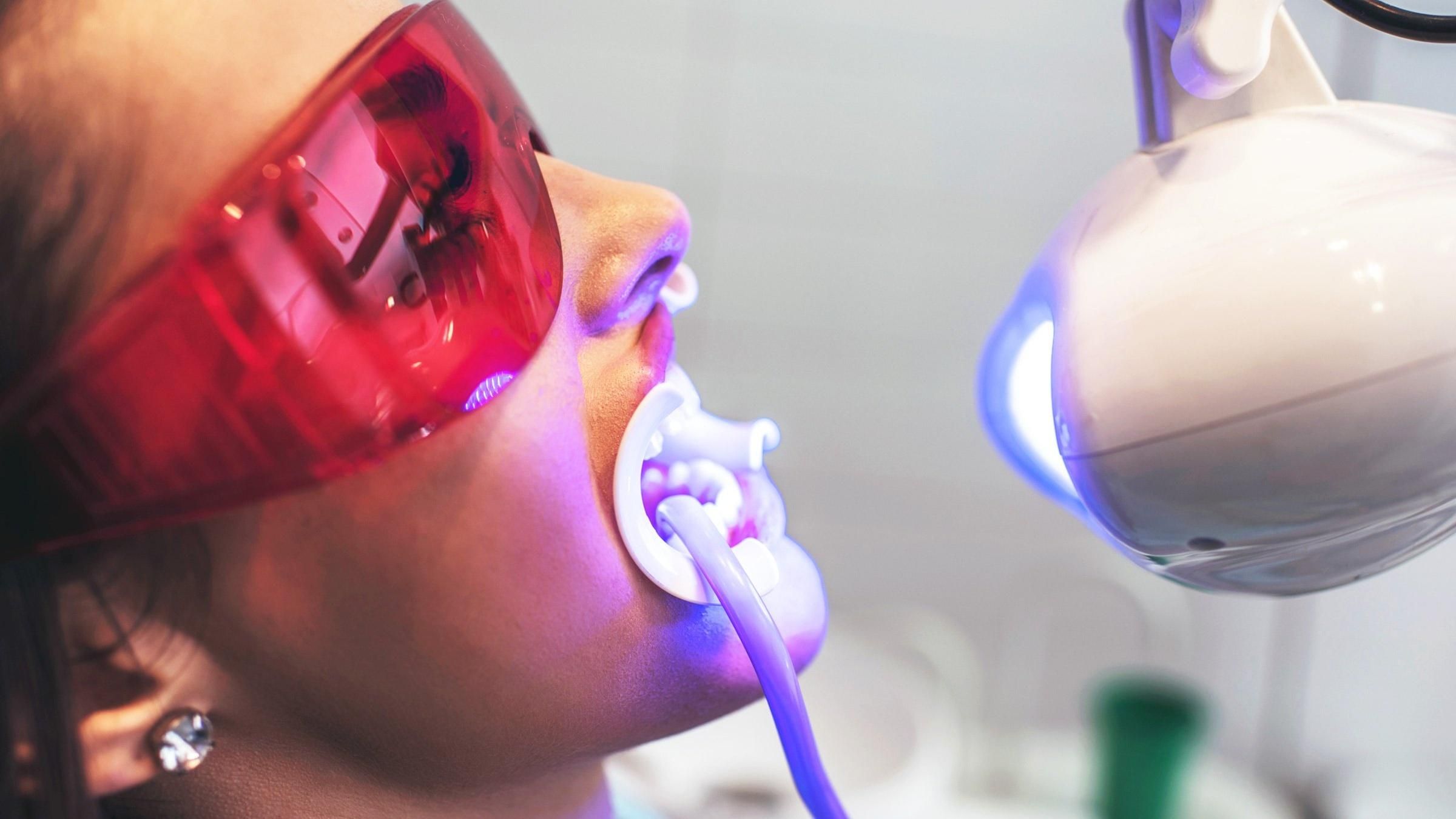 Що можна їсти після відбілювання зубів Що можна їсти після відбілювання зубів