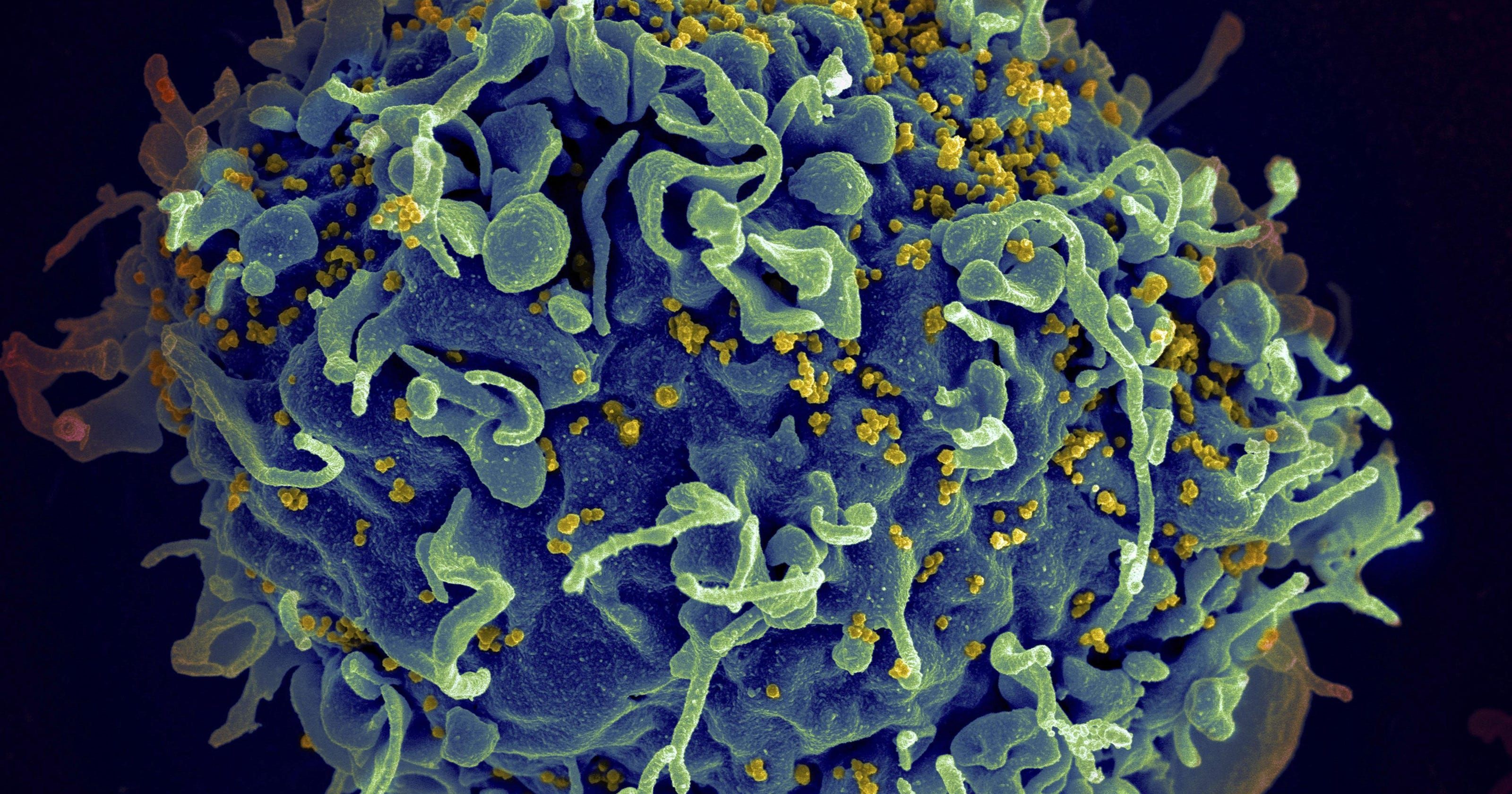 Вчені знайшли спосіб знищувати приховані віруси ВІЛ
