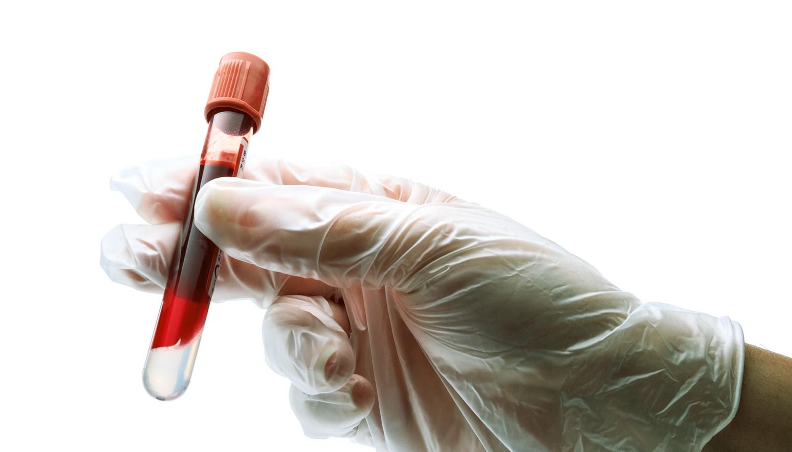 Новый анализ крови точно определяет более 20 типов рака
