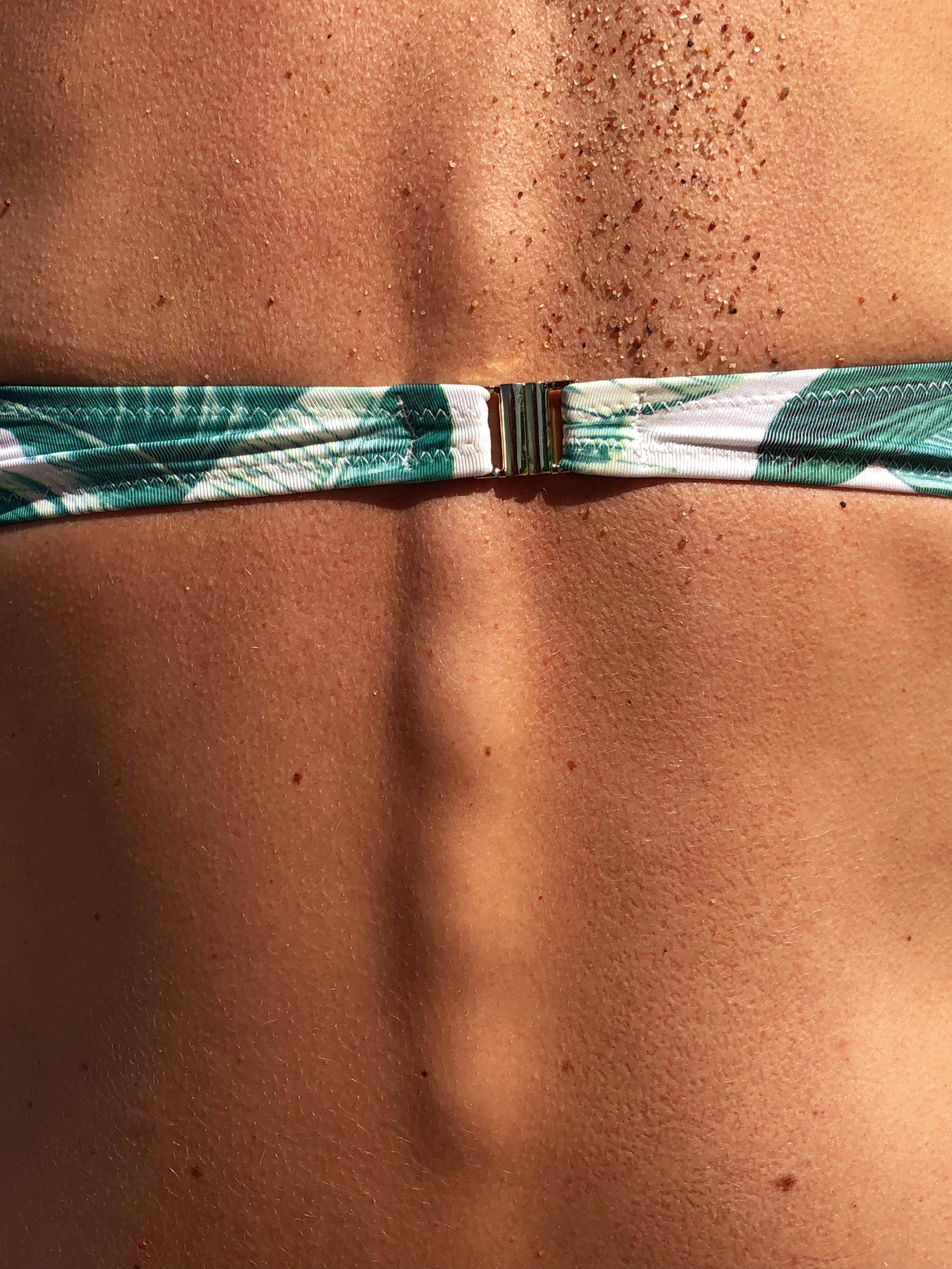 Почему появляется "гусиная кожа" и как это лечить