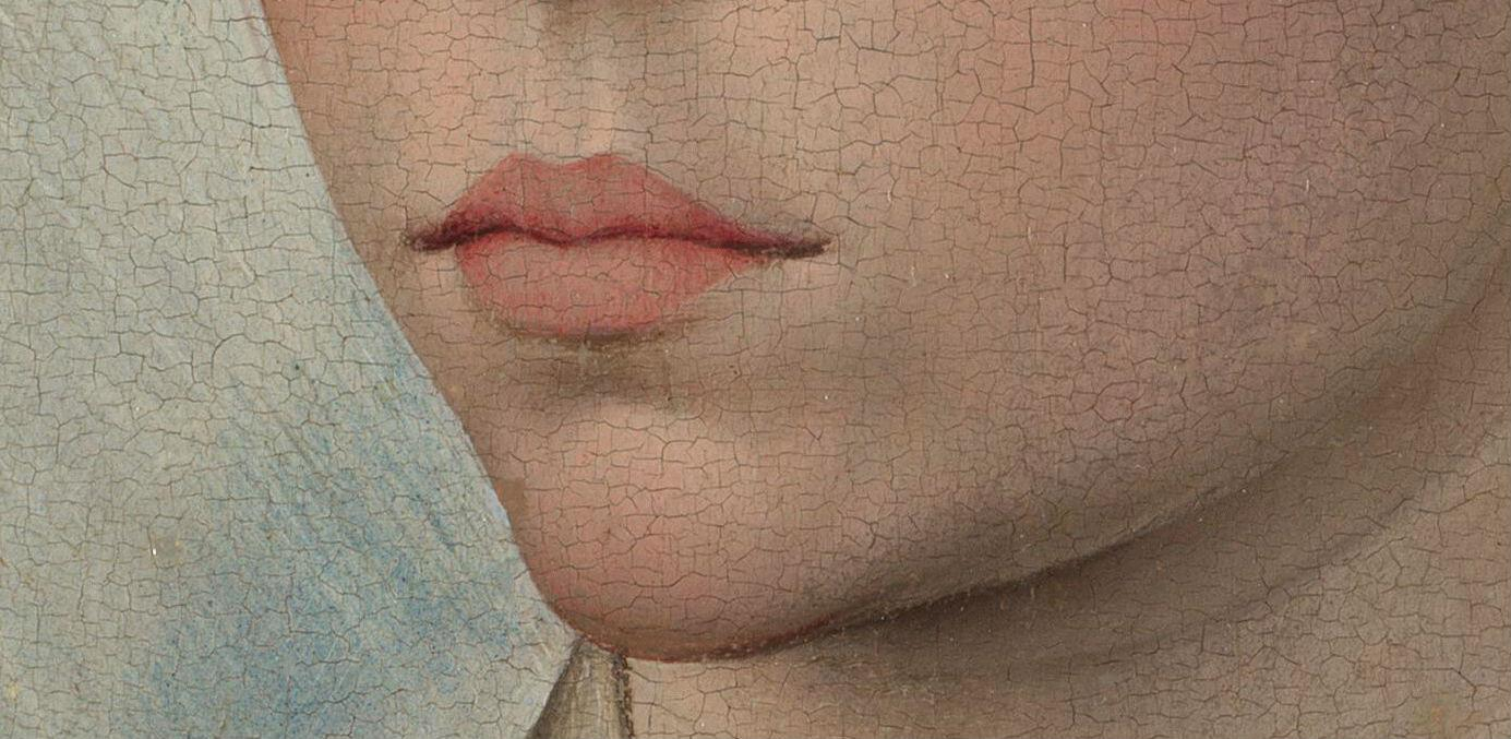 Бледность губ: анемия, переутомление и другие причины