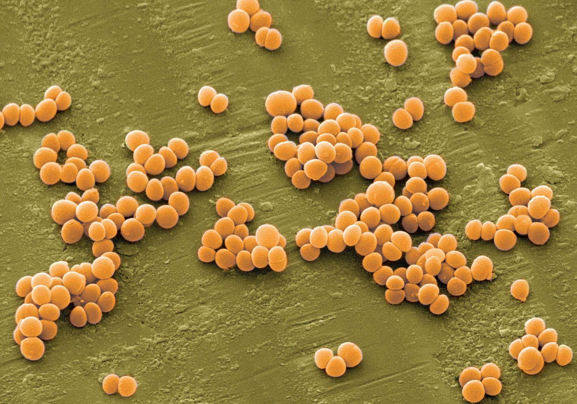 Золотистый стафилококк – новое лекарство для борьбы с супербактериями