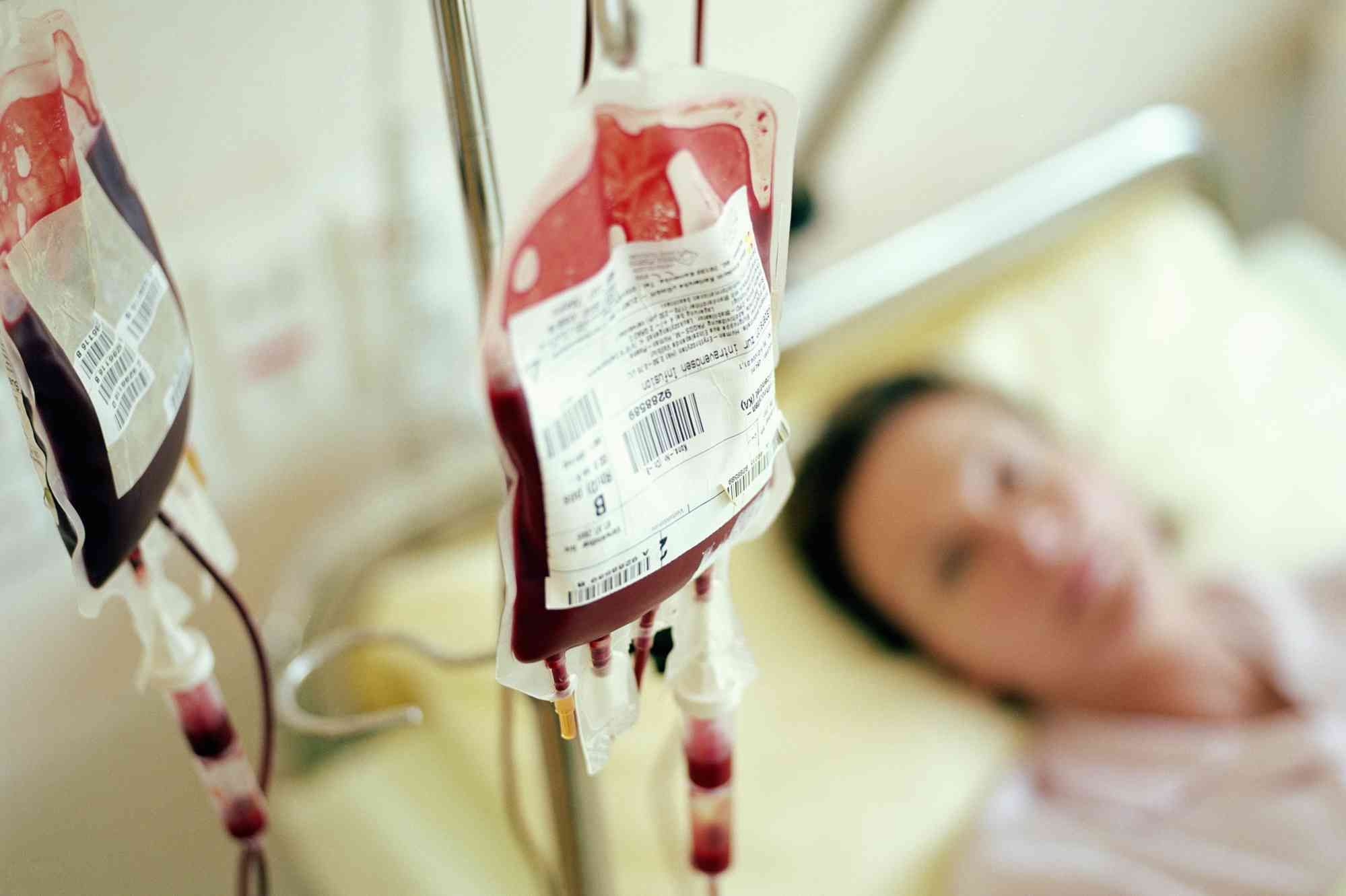 Як очистити кров: які методи існують та наскільки вони ефективні 