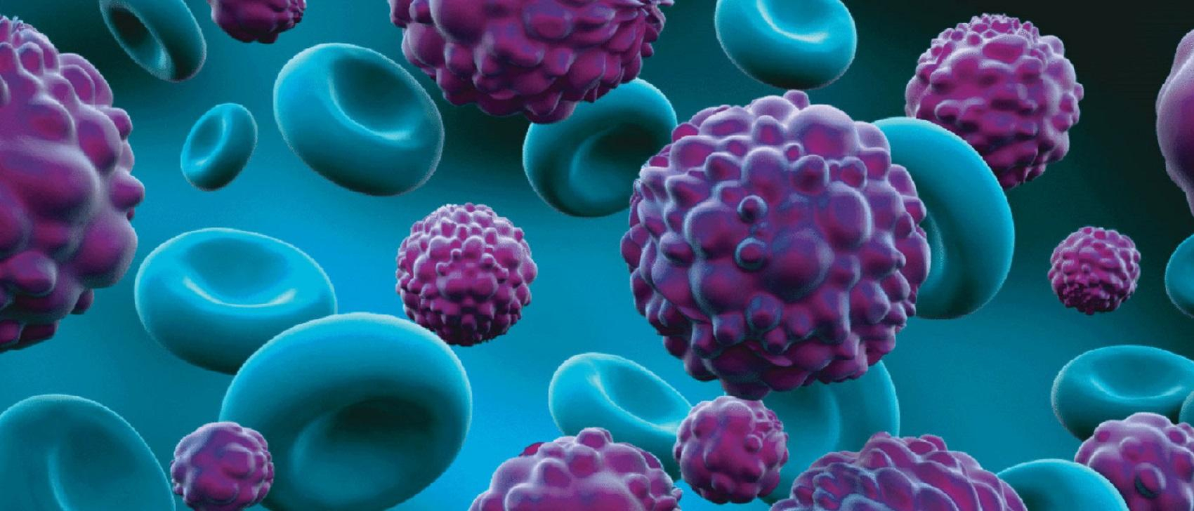 Искусственный интеллект научили прогнозировать рак