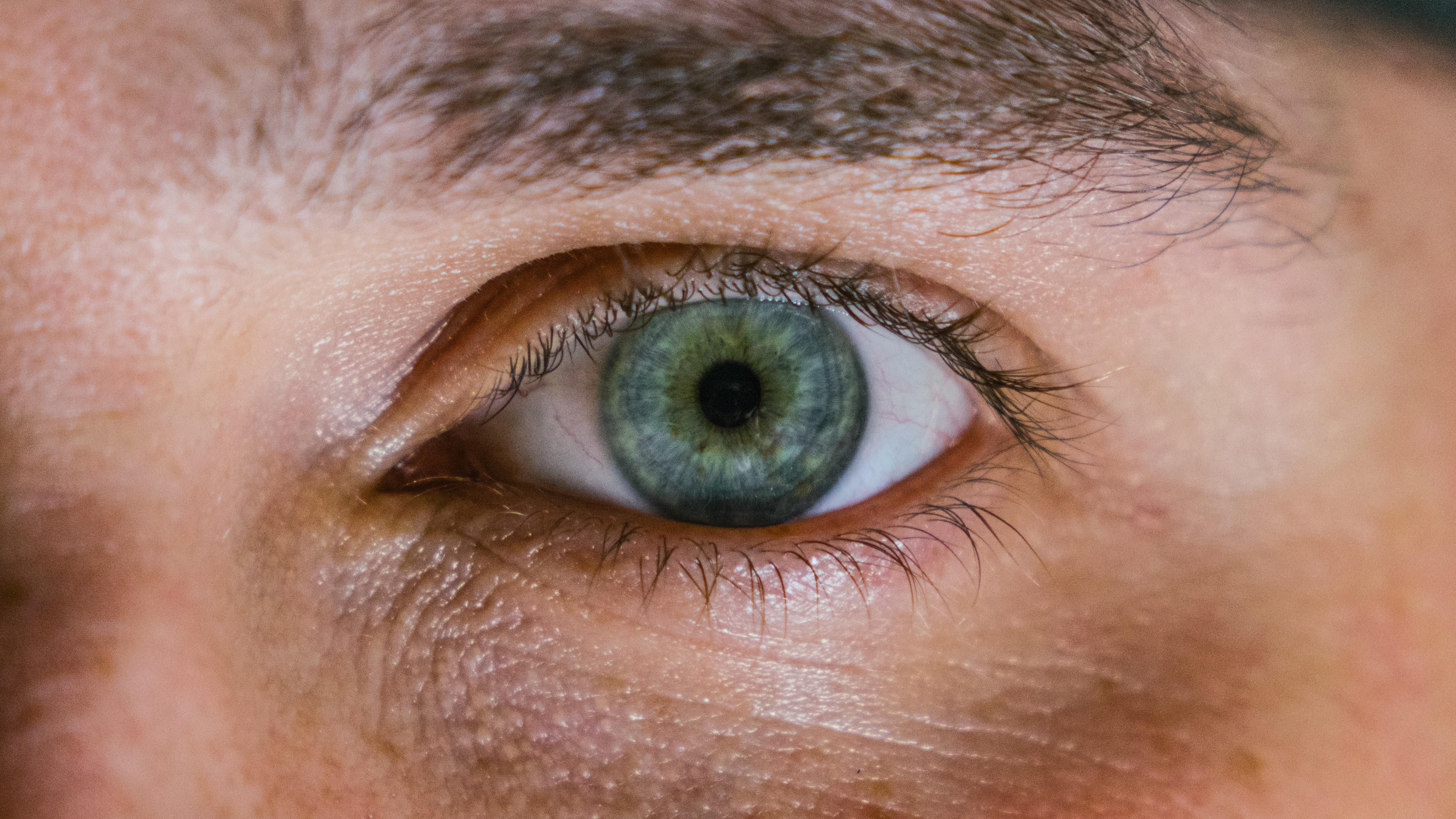 Синдром сухого ока: чому виникає, профілактика та лікування