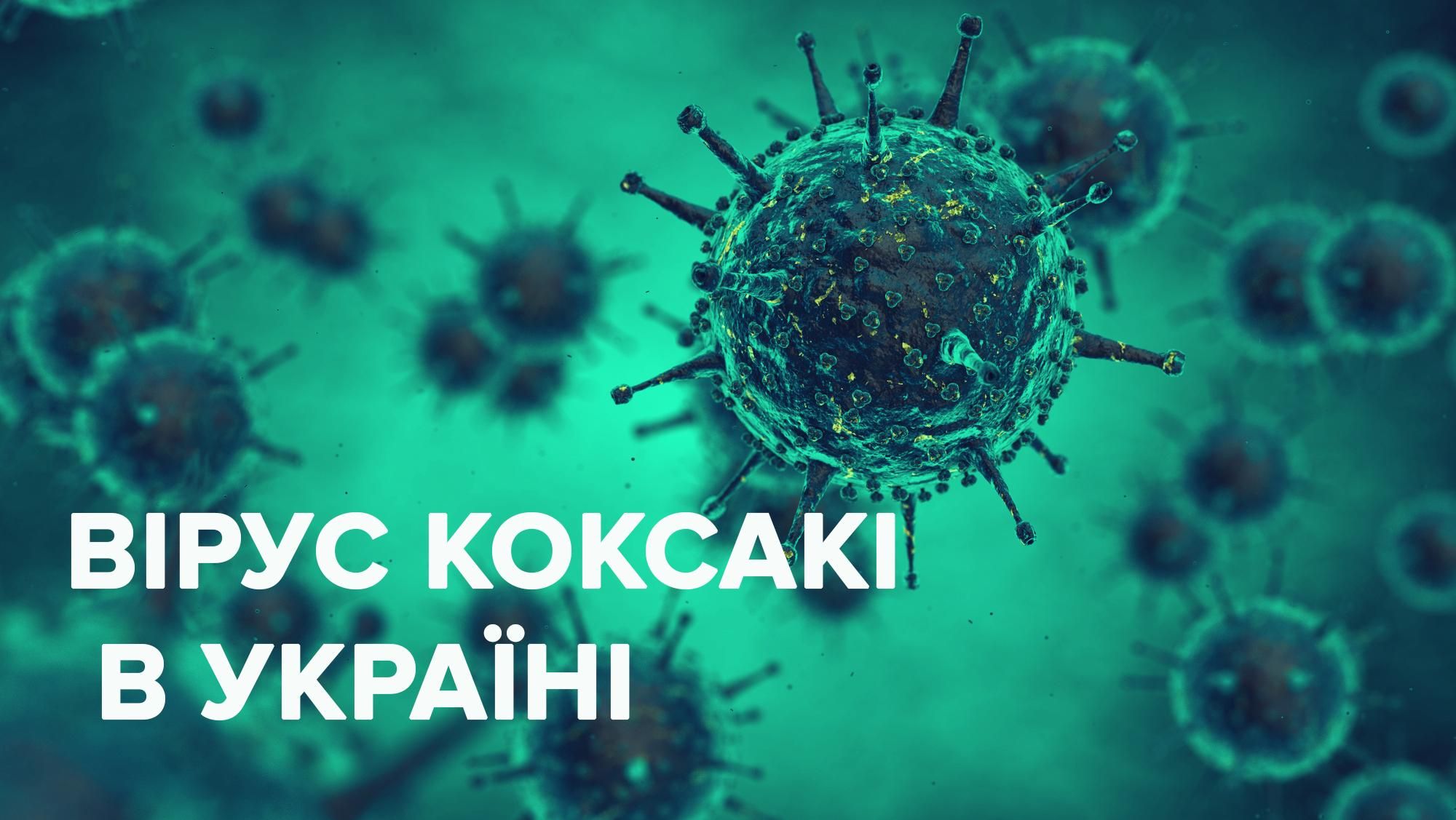 Вірус Коксакі в Україні 2019 – що це, лікування, діагностика