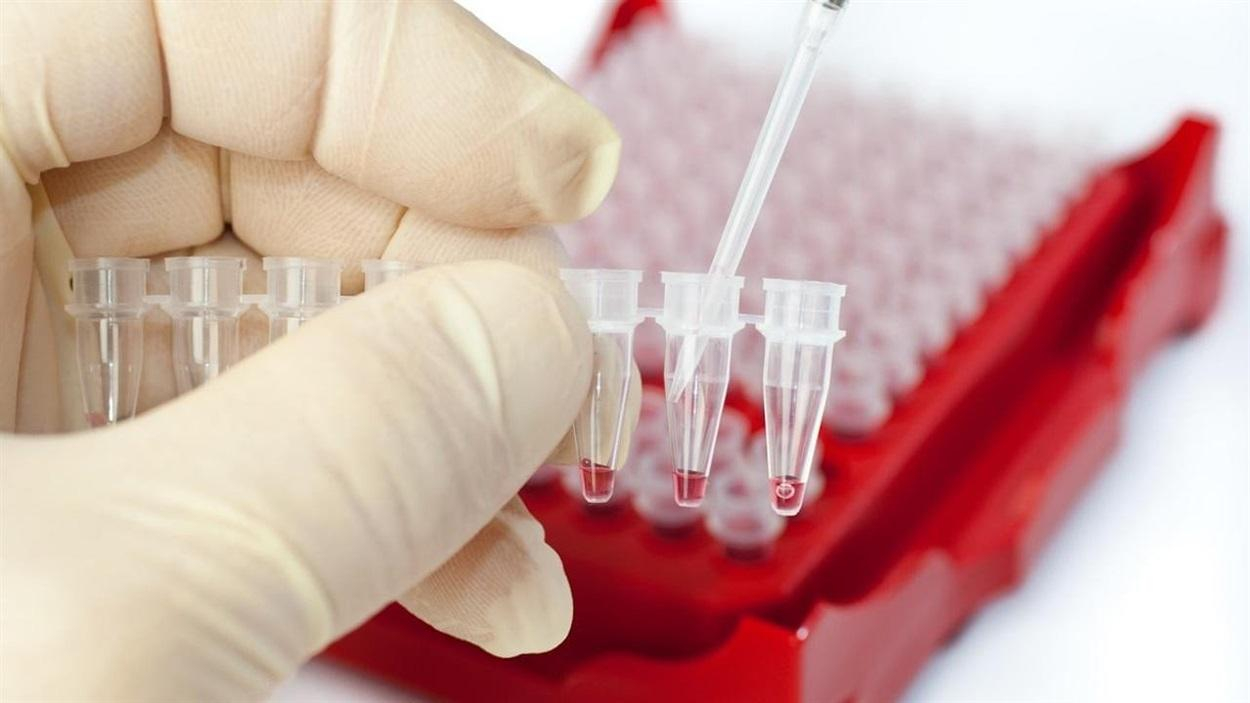 Создали первый в мире банк спермы для ВИЧ-инфицированных