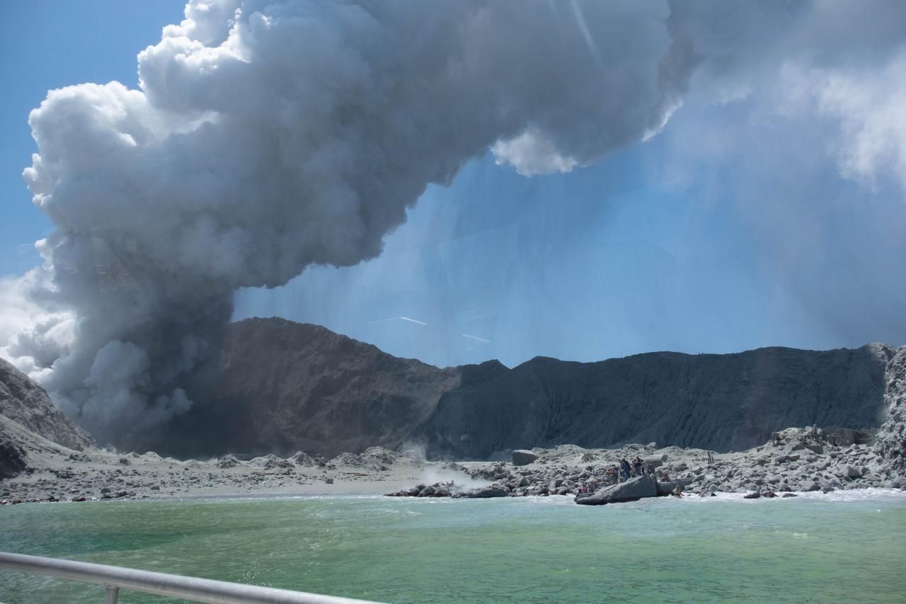 Пострадавшим от извержения вулкана в Новой Зеландии пересаживают кожу мертвых людей