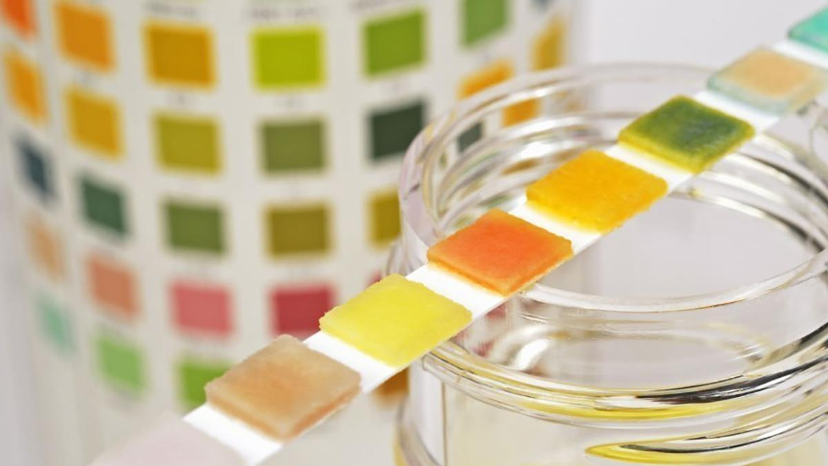 Сдача мочи на анализ – как подготовиться и правильно сдать мочу 