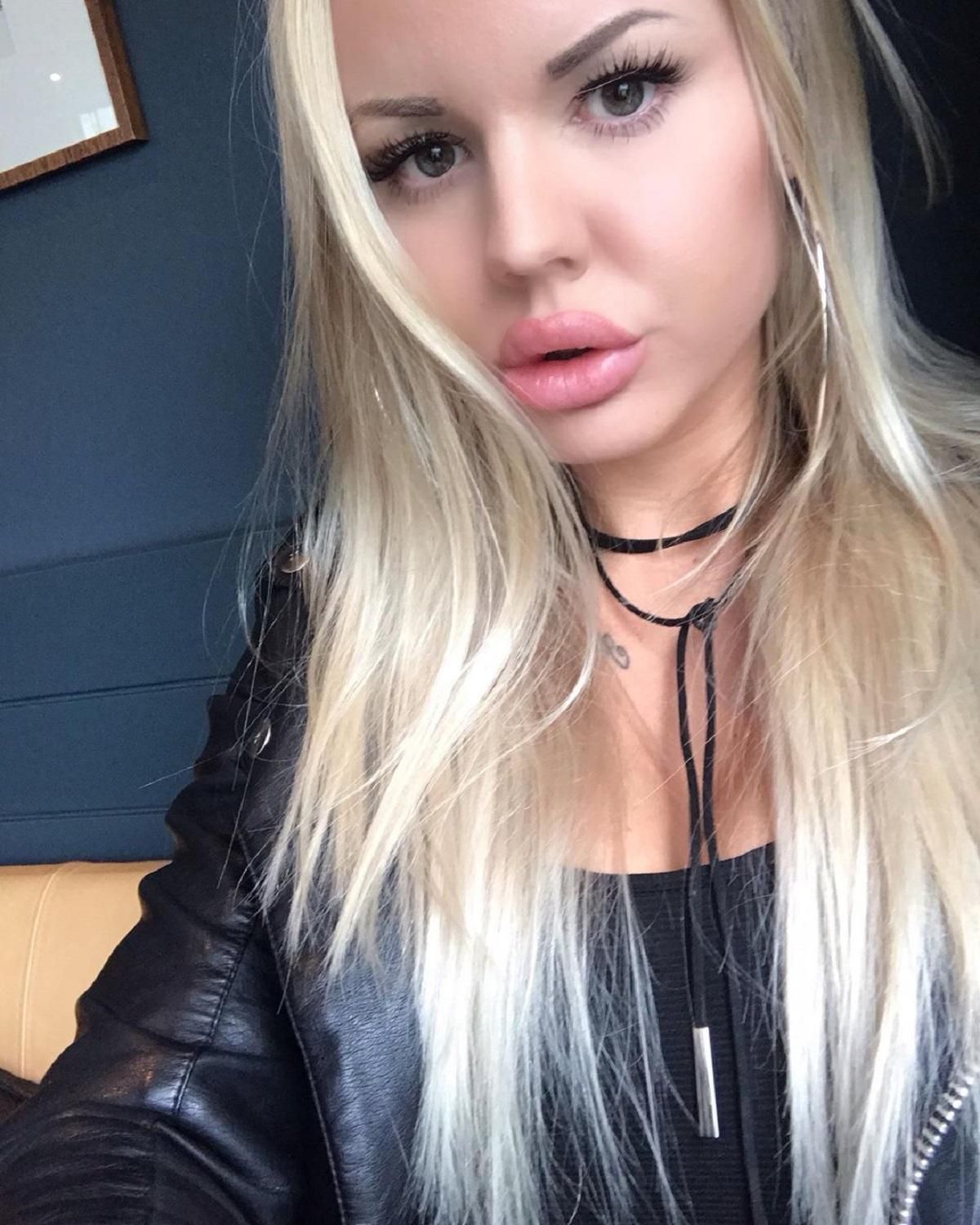 "Імплант почав випадати з грудей": шведка постраждала від пластичної операції в Туреччині "Імплант почав випадати з грудей": шведка постраждала від пластичної операції в Туреччині