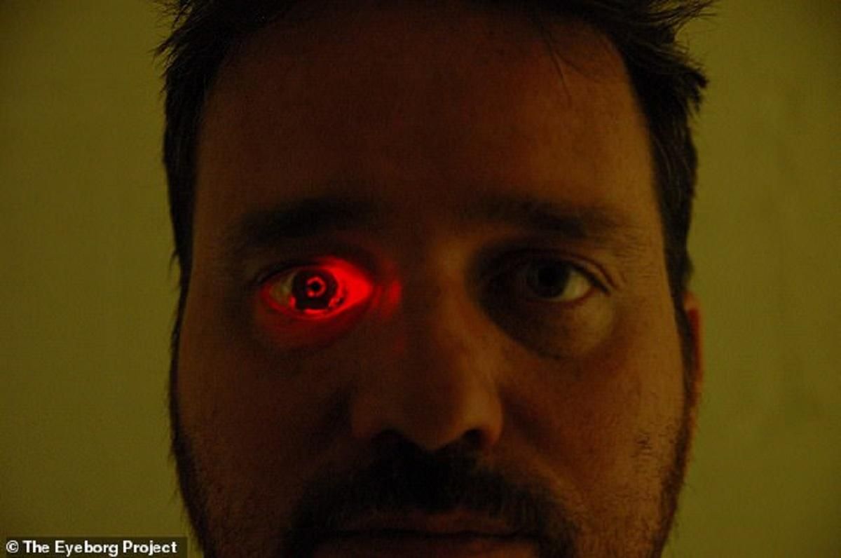 Канадец вставил видеокамеру вместо потерянного глаза: фото