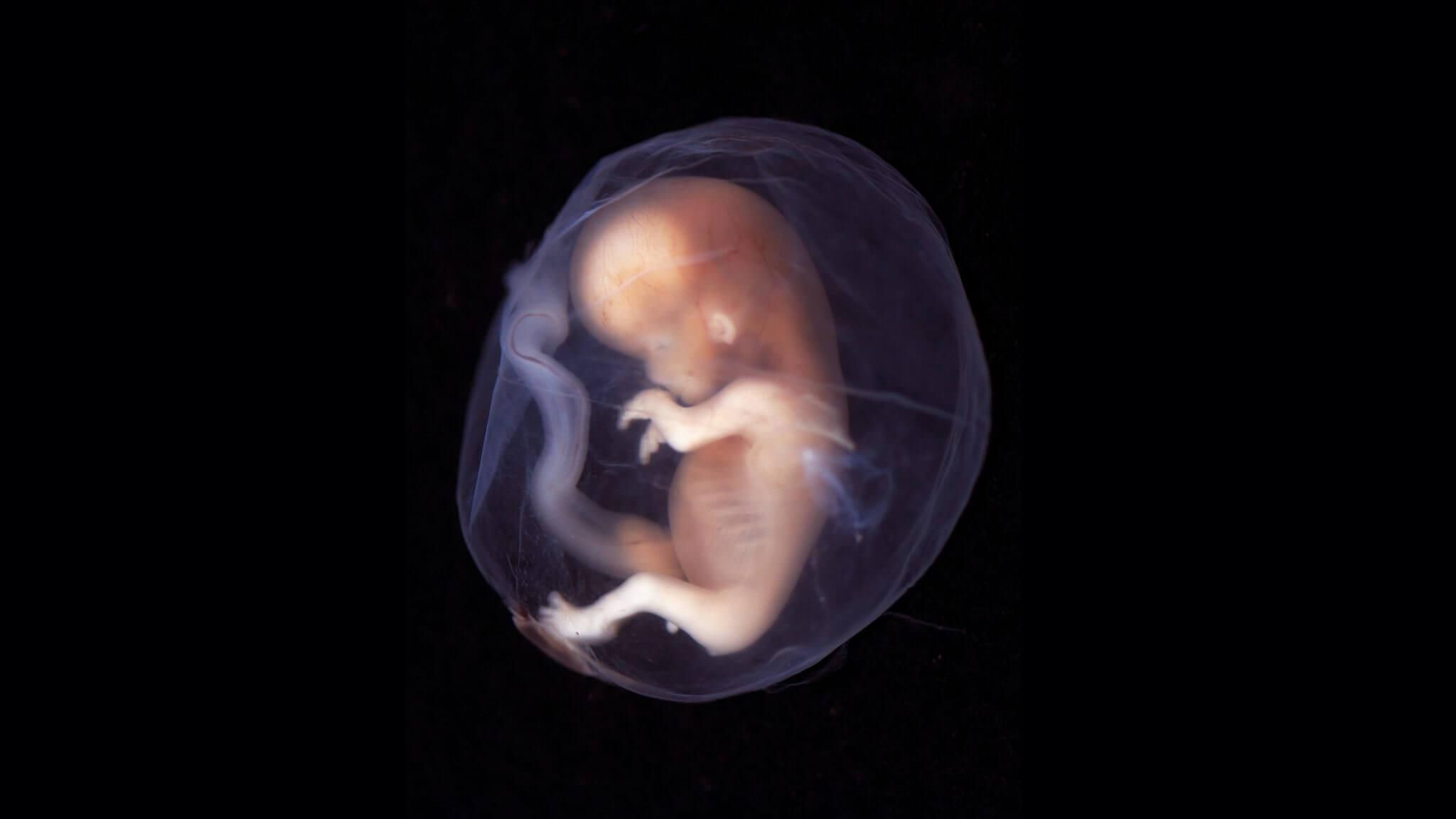 У человеческих эмбрионов обнаружили признаки старения