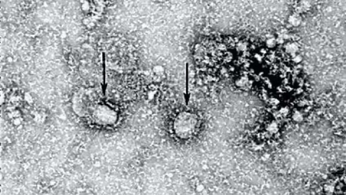 Тести для перевірки на коронавірус з Китаю будуть в Україні до кінця тижня, – МОЗ 