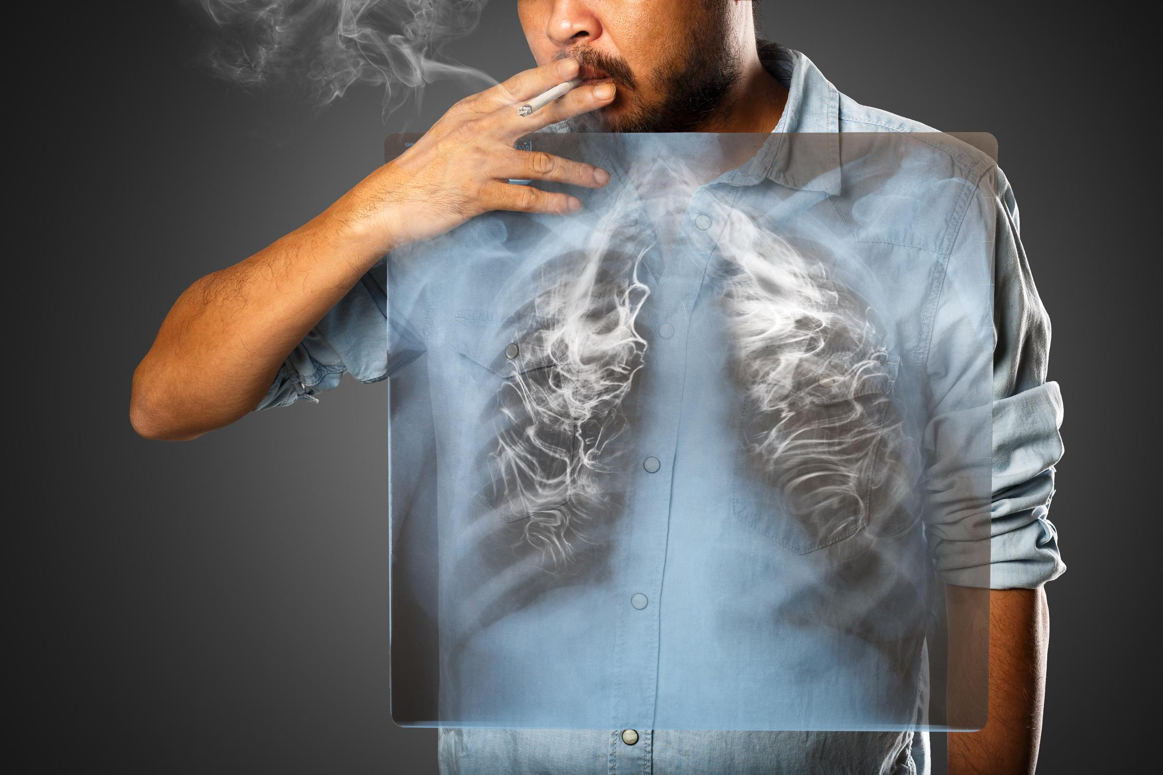 Легені, пошкоджені курінням, можуть повністю загоюватися: дослідження